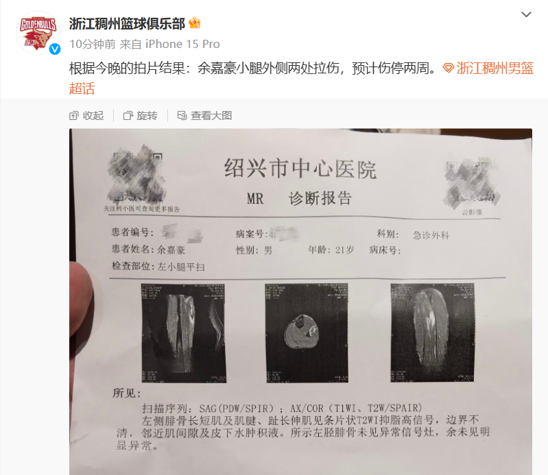 🤕浙江男篮官宣：余嘉豪小腿外侧两处拉伤，预计伤停两周
